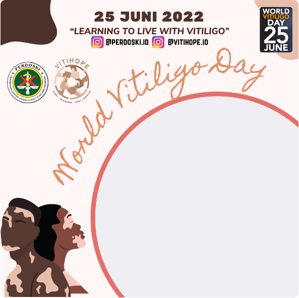 Twibbon Hari Vitiligo Sedunia ke-12 Tahun 2022