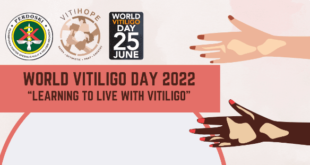 Twibbon Hari Vitiligo Sedunia ke-12 Tahun 2022