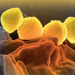 Sel Streptococcus pyogenes (berwarna kuning) yang berada di