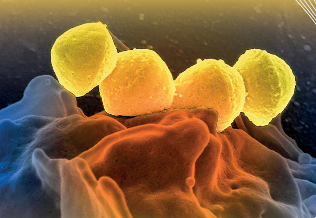Sel Streptococcus pyogenes (berwarna kuning) yang berada di
